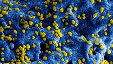 Coronavirus: Blijf thuis bij gezondheidsklachten